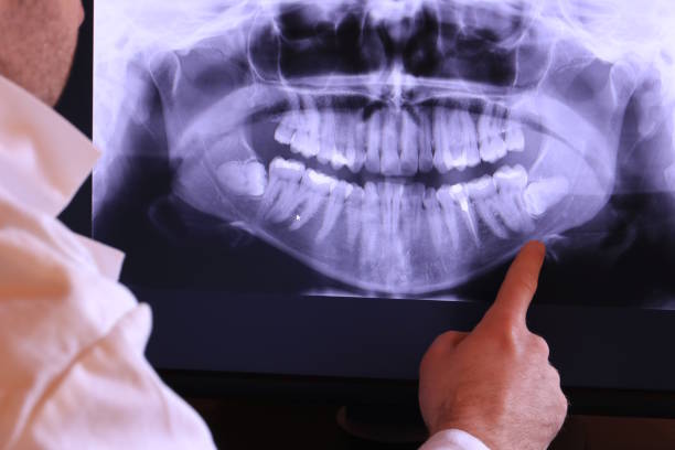 Best Knocked-Out Tooth Emergency  in Lake Barcroft, VA