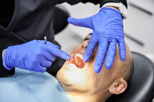 Best Dentist for Tooth Abscess  in Lake Barcroft, VA