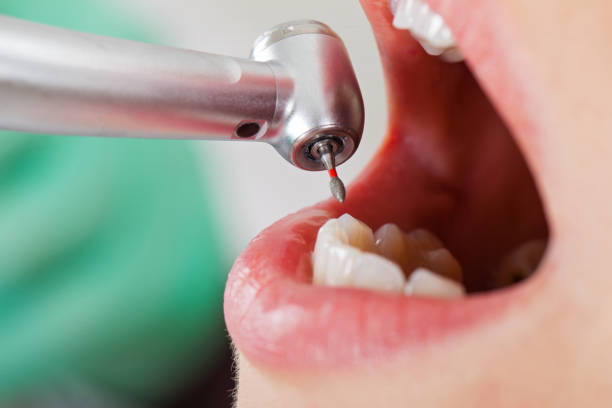 Best Emergency Pediatric Dentist  in Lake Barcroft, VA